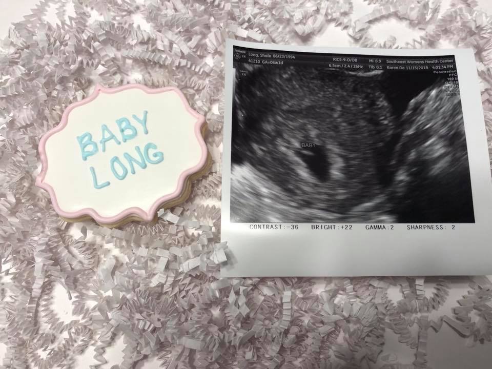 That “Clump of Cells” Has a Heartbeat—And You Know&nbsp;It